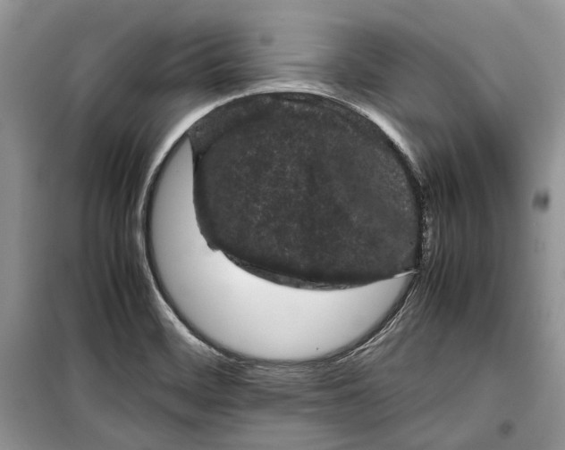 X0000099291468200805161314