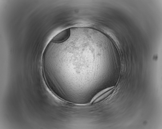 X0000099291487200805161313