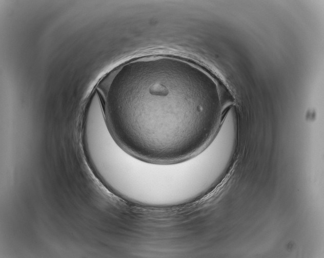 X0000099291500200805161313