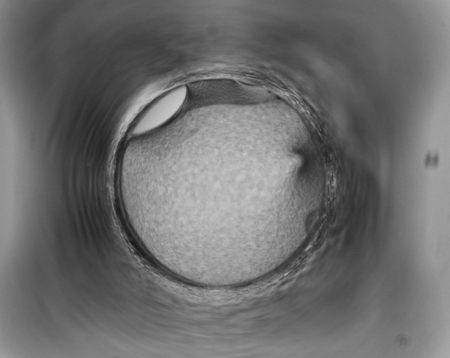 X0000099290006200805231330