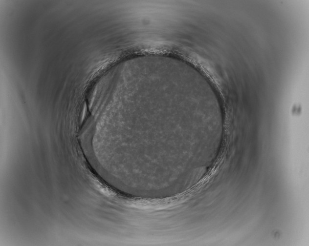 X0000099290017200805231330