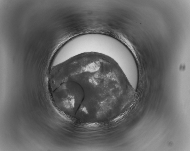 X0000099290059200805231329