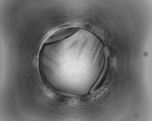 X0000099290148200805231328