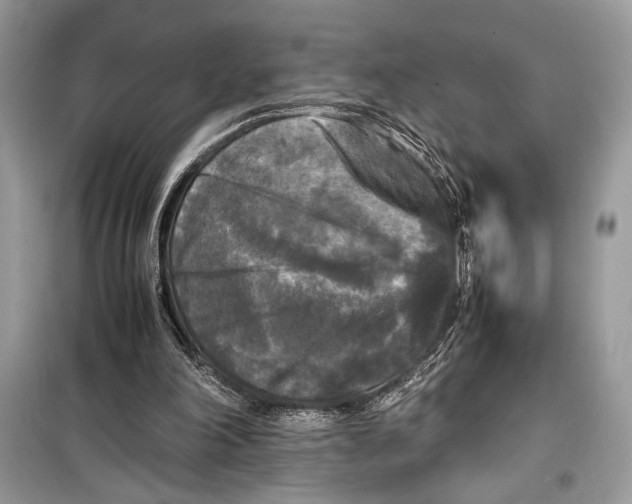 X0000099290198200805231328