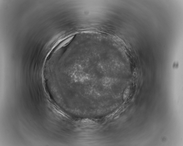 X0000099290290200805231326