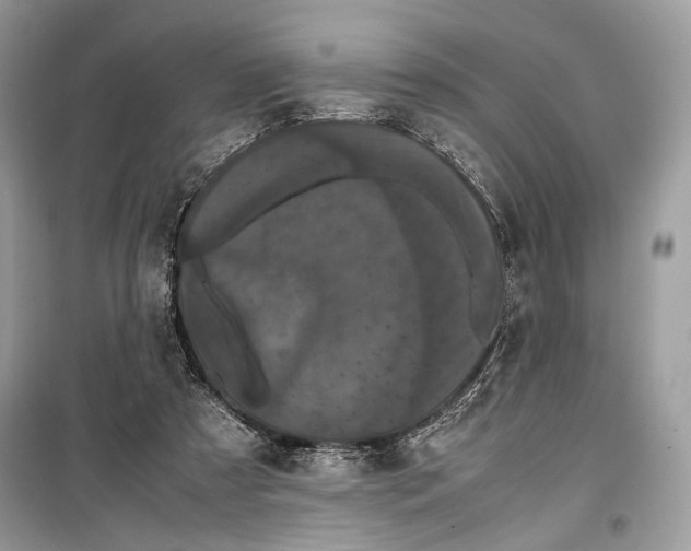 X0000099290305200805231326