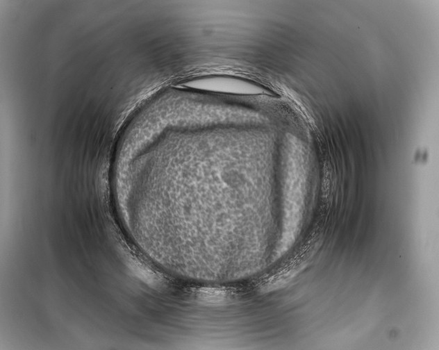 X0000099290394200805231325