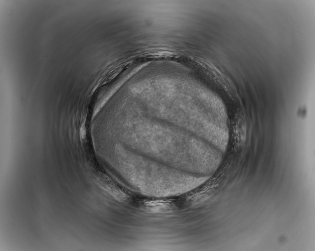 X0000099290516200805231323