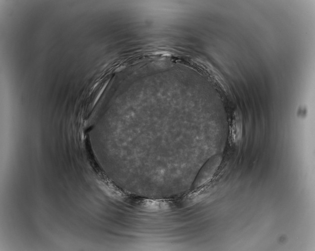 X0000099290520200805231323