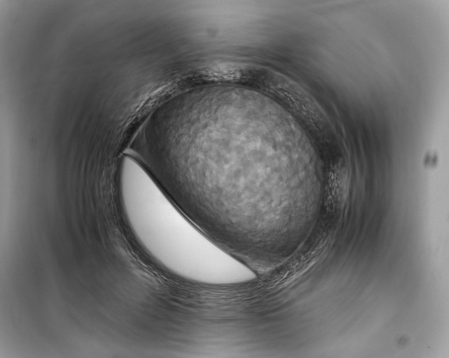 X0000099290600200805231322