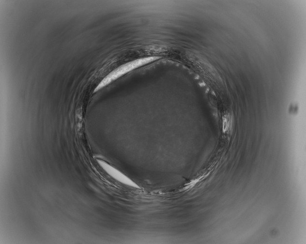 X0000099291011200805231316