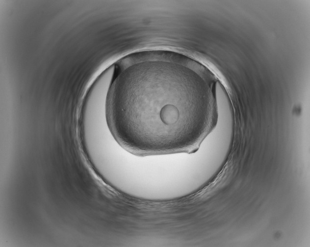 X0000099291101200805231315