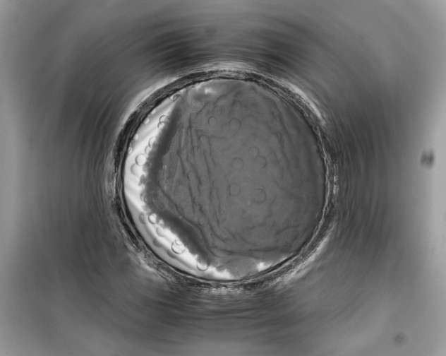 X0000099291117200805231315