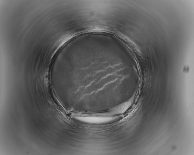 X0000099291170200805231314