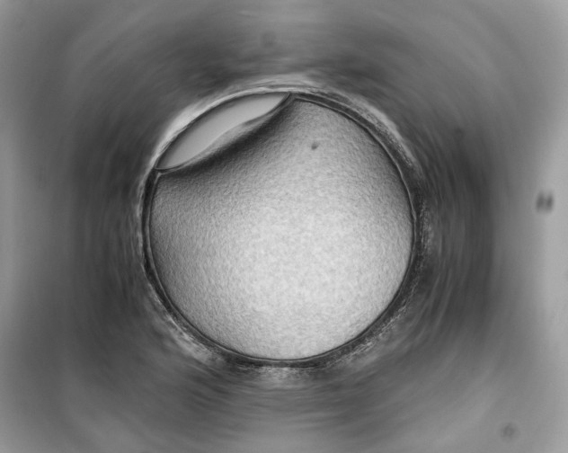 X0000099291176200805231314