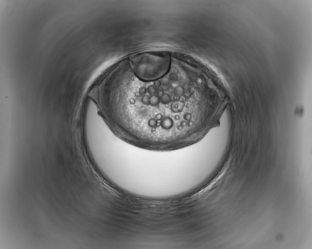 X0000099291317200805231312