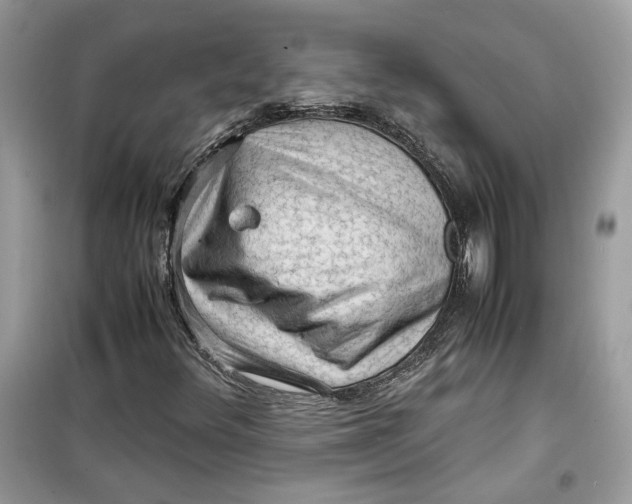 X0000099291348200805231311