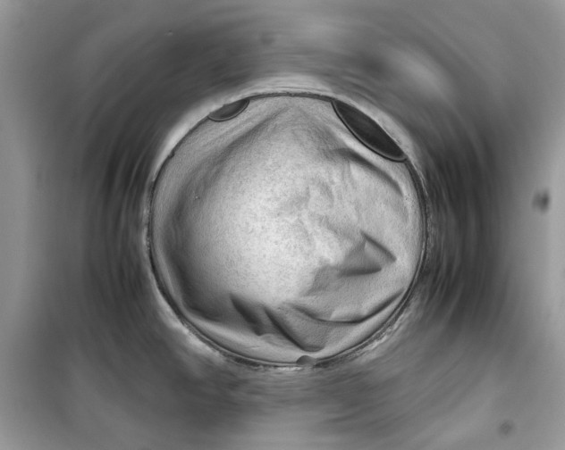 X0000099291390200805231311