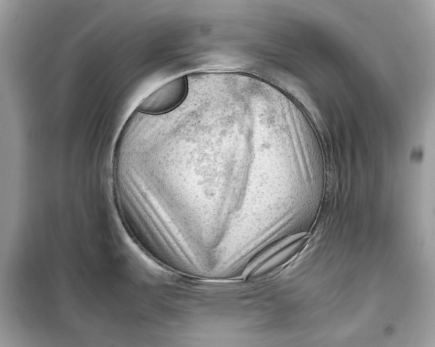 X0000099291487200805231309