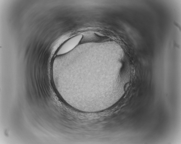 X0000099290006200805301122