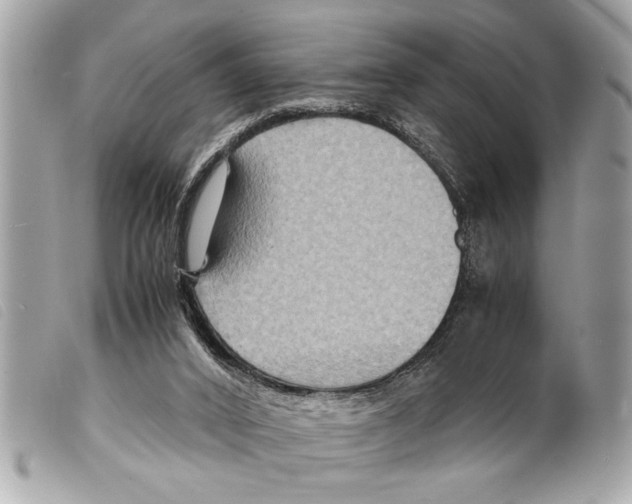 X0000099290016200805301122
