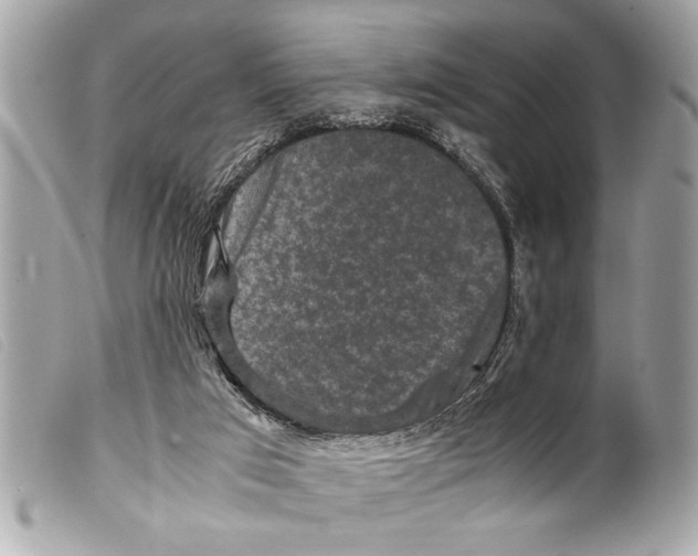 X0000099290017200805301122