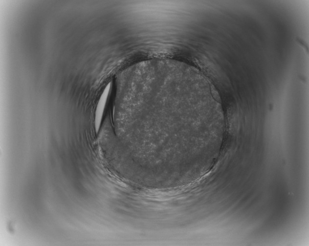 X0000099290041200805301121