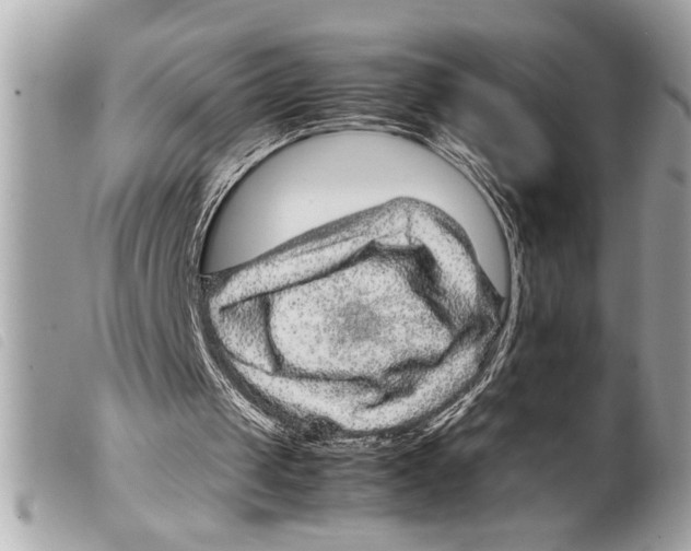 X0000099290049200805301120