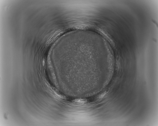 X0000099290117200805301120