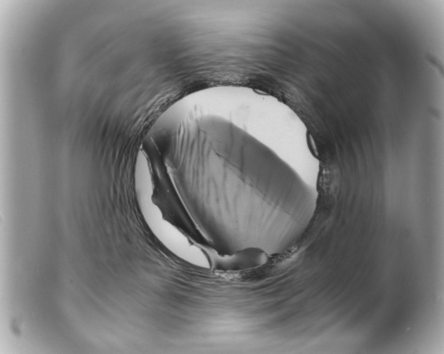 X0000099290143200805301120
