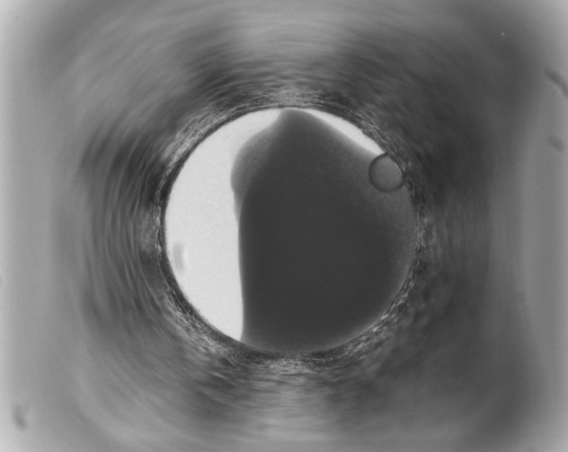 X0000099290146200805301119