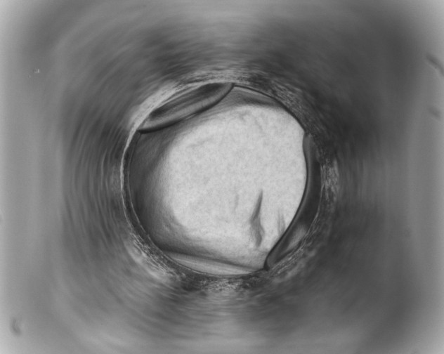 X0000099290148200805301119