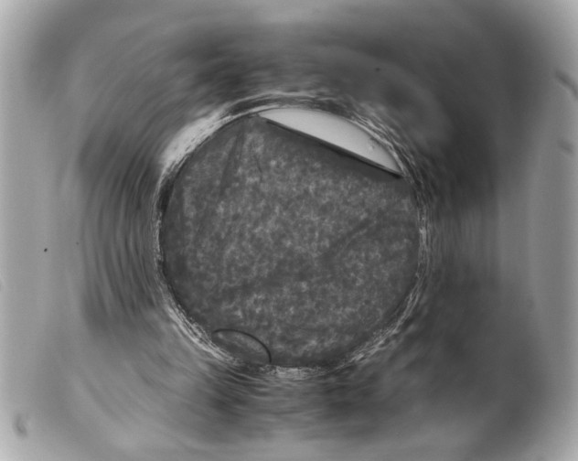 X0000099290149200805301119