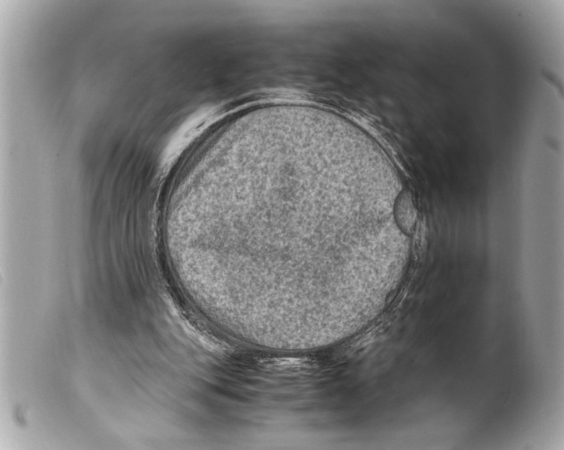 X0000099290151200805301119