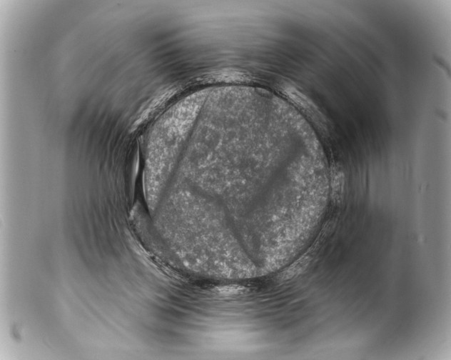 X0000099290158200805301119