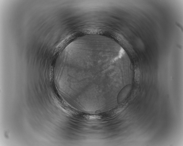 X0000099290165200805301119