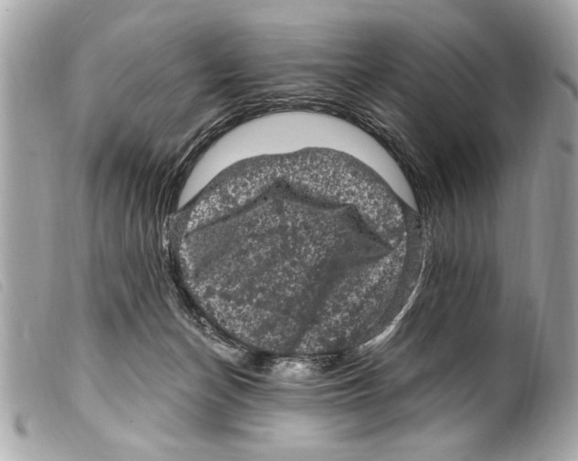 X0000099290174200805301119