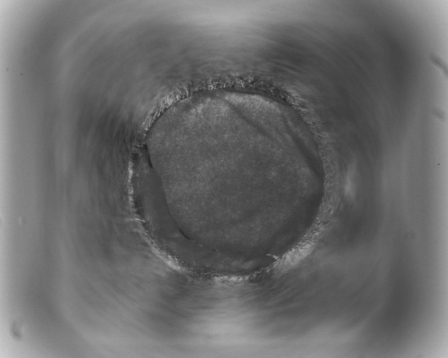 X0000099290192200805301120