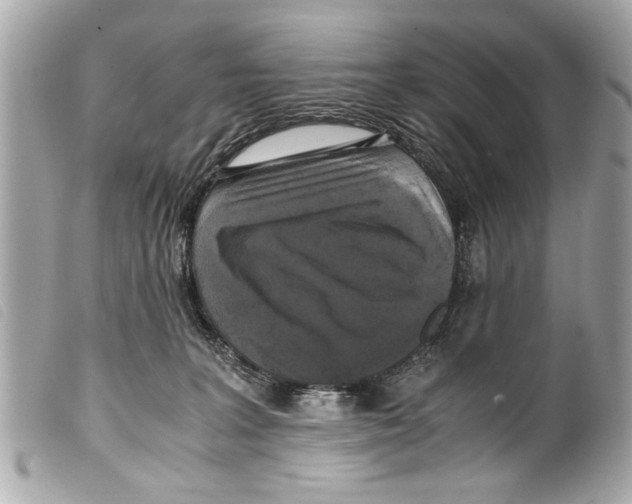 X0000099290227200805301119