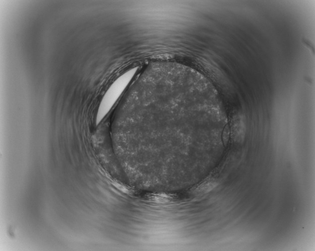 X0000099290229200805301118