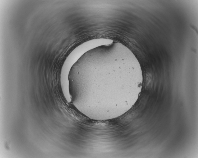 X0000099290236200805301118