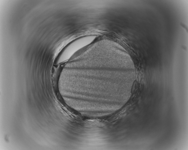X0000099290244200805301118