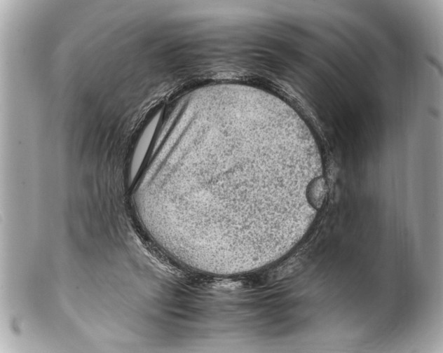 X0000099290257200805301118