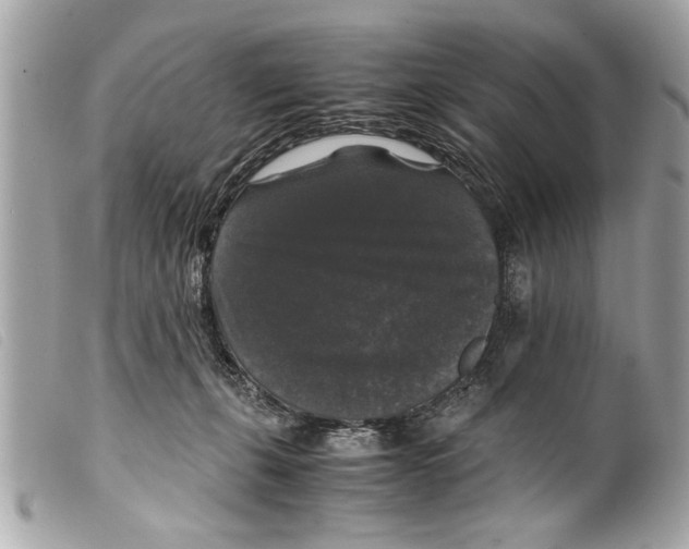 X0000099290271200805301118