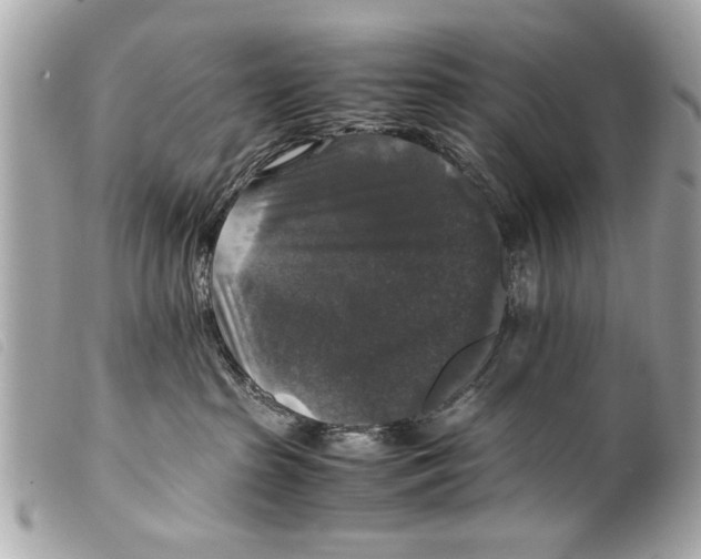 X0000099290285200805301118