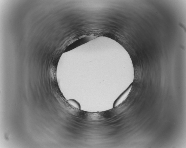 X0000099290287200805301118