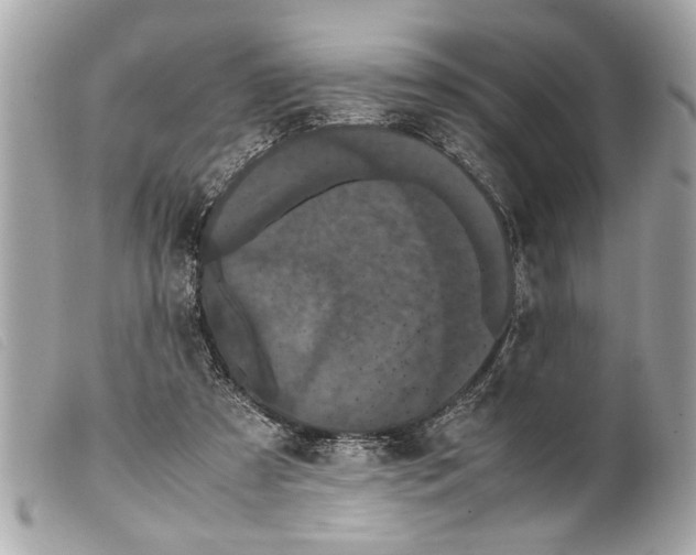 X0000099290305200805301118