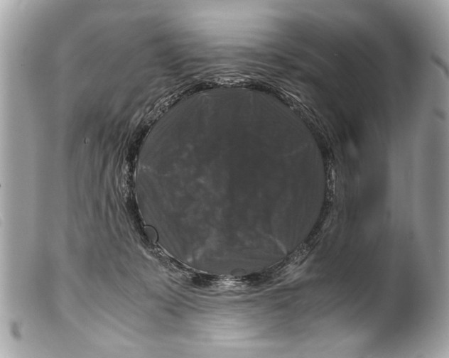 X0000099290319200805301117