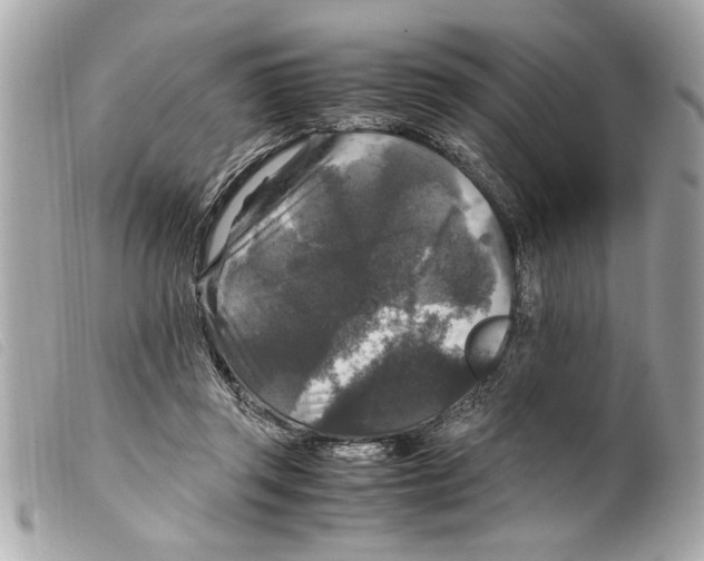 X0000099290357200805301117