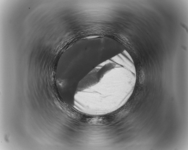 X0000099290366200805301117